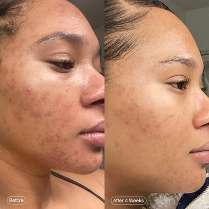 Faded Serum for Dark Spots & Discoloration *preorder*